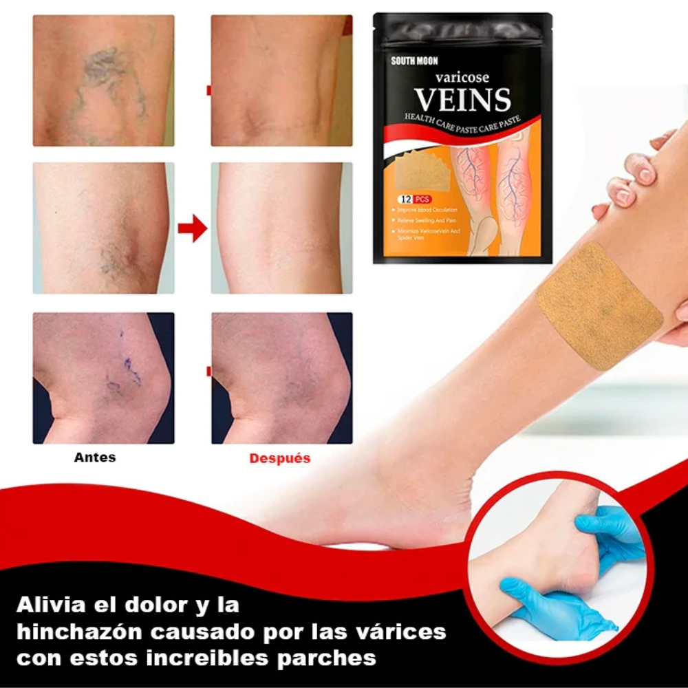 PACK 4X1🎁 PARCHES PARA VÁRICES (48 UND)